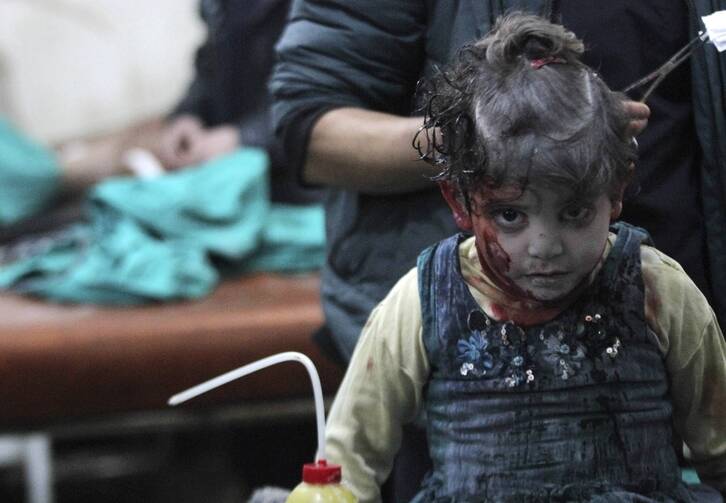 An injured girl waits for treatment in a field hospital after what activists said was an airstrike by forces loyal to Syrian President Bashar Assad in Damascus Jan. 28. (CNS photo/Mohammed Badra, Reuters)