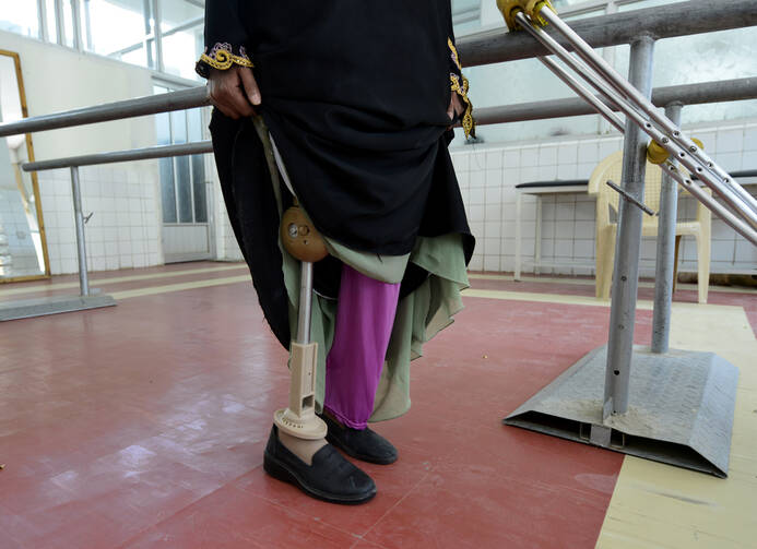 A victim of a landmine tries out a prosthetic limb. Pope Francis is urging international action to rid the world of landmines, which, he said, prolong war and nurture fear. (CNS photo/Yahya Arhab, EPA)