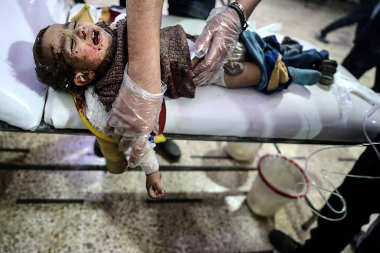 An injured child receives medical attention after a bombing March 4 in Douma, Syria. Cardinal Mario Zenari, the apostolic nuncio in Syria, said "I have never seen so much violence as in Syria." In remarks March 9, he likened the situation to the 1994 Rwandan genocide. (CNS photo/Mohammed Badra, EPA)