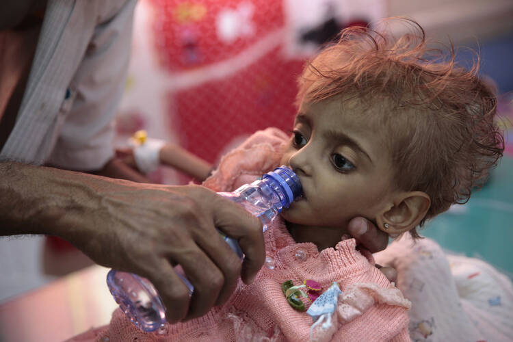 A father gives water to his malnourished daughter at a feeding center in a hospital in Hodeida, Yemen, on Sept. 27. (AP Photo/Hani Mohammed, File)