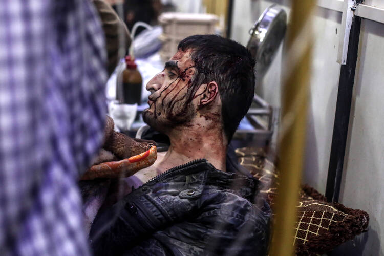 An injured man receives treatment inside a field hospital in Douma, Syria, after April 3 airstrikes(CNS photo/Mohammed Badra, EPA).