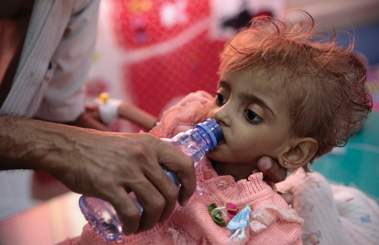 A father gives water to his severely malnourished daughter at a feeding center in Hodeida, Yemen, in September 2018. (AP Photo/Hani Mohammed, File)