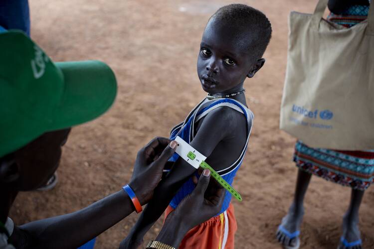 A young boy has his arm measured in October 2016 to see if he is suffering from malnutrition during a nutritional assessment at an emergency medical facility supported by UNICEF in Kuach, on the road to Leer, in South Sudan. Famine has been declared Monday, Feb. 20, 2017 in two counties of South Sudan. (Kate Holt/UNICEF via AP)