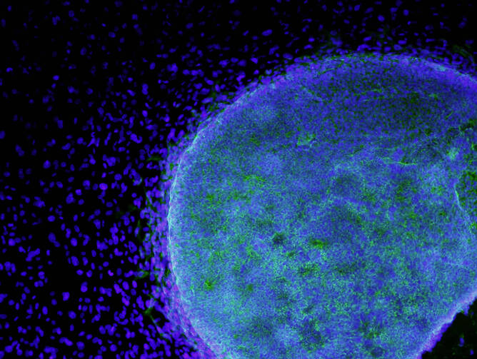A microscopic view shows a colony of human embryonic stem cells (light blue) growing on fibroblasts (dark blue). The Catholic Church has long opposed embryonic stem-cell research because it relies on the destruction of human embryos.