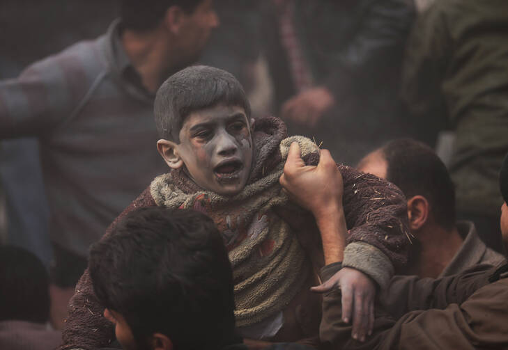 A wounded boy after an air strike over Damascus
