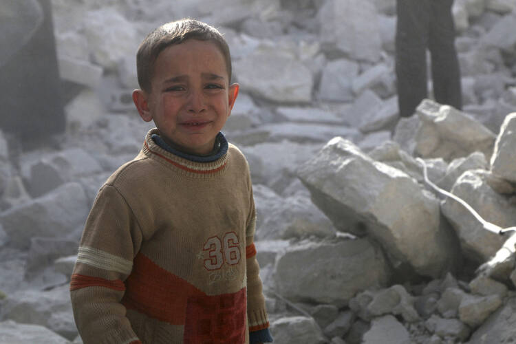 A child survivor of a 'barrel bomb' attack in Aleppo, Syria.